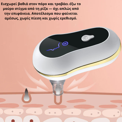 Blackhead Cleaner
